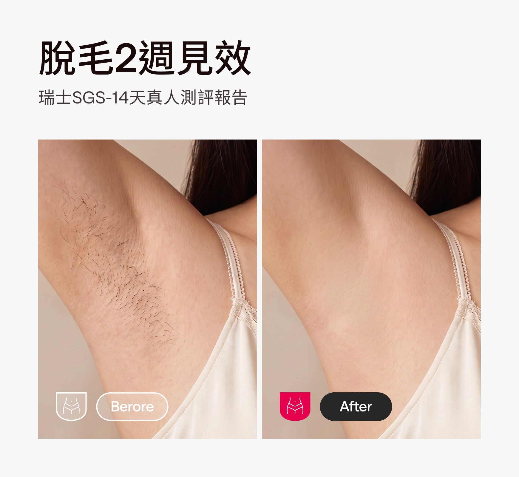 Ulike Air10家用脫毛儀-限時團購