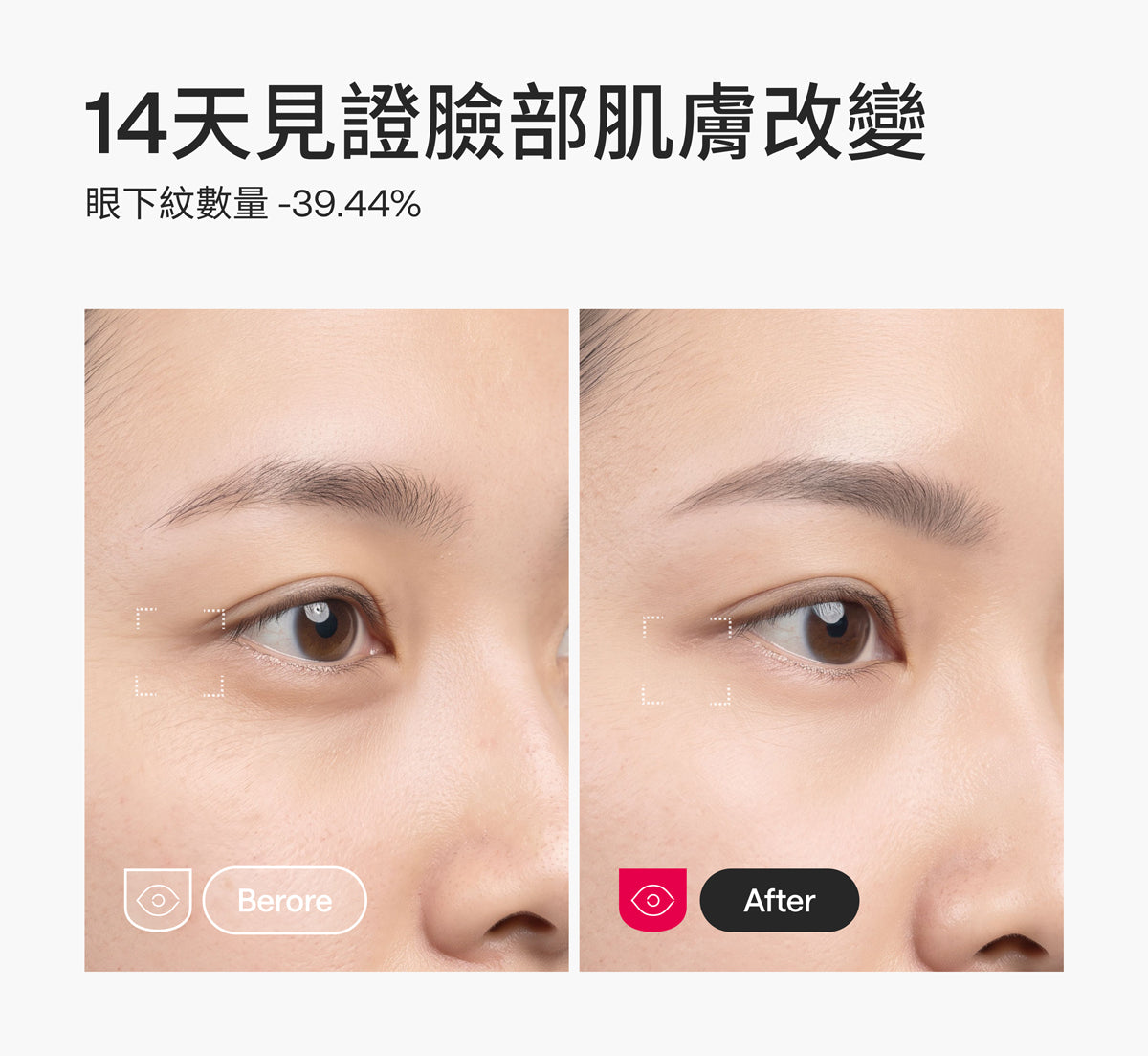 Ulike白皇后LED美容面膜儀-限時團購
