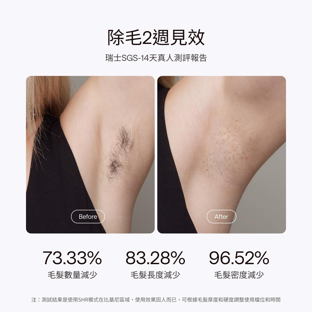 Ulike Air10家用脫毛儀