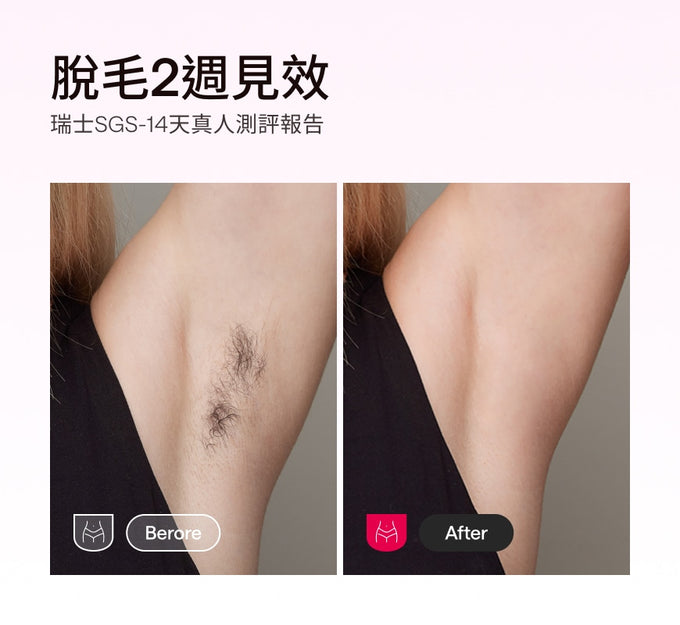 Ulike x Hello Kitty Air10限量版脫毛儀