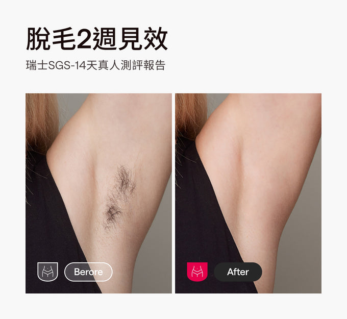 Ulike Air10家用脫毛儀