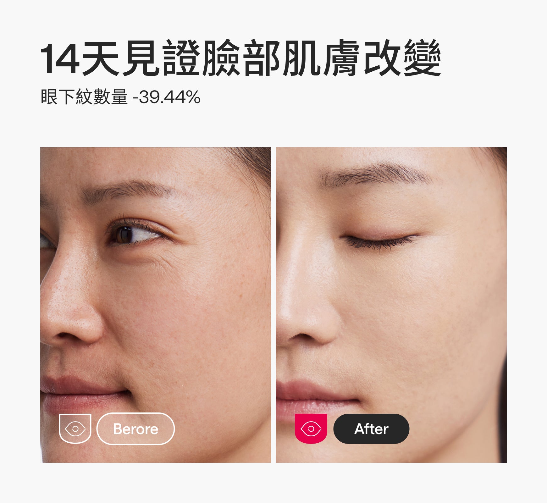 Ulike白皇后LED美容面膜儀 -  IG限時團購