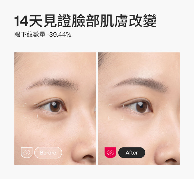Ulike白皇后LED美容面膜儀