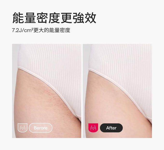 Ulike Swift 7藍寶石家用脫毛儀